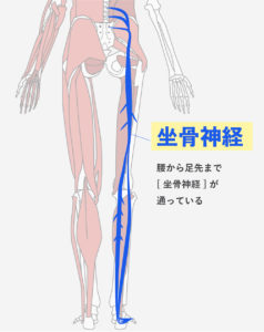 ヘルニアによる神経の圧迫